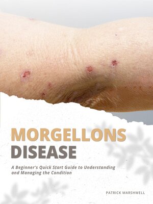 cover image of Morgellons Disease